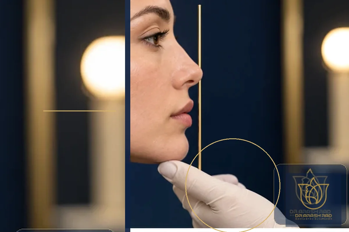 5 New Perspectives on Jawline Contour and Double Chin: Beyond Surgery