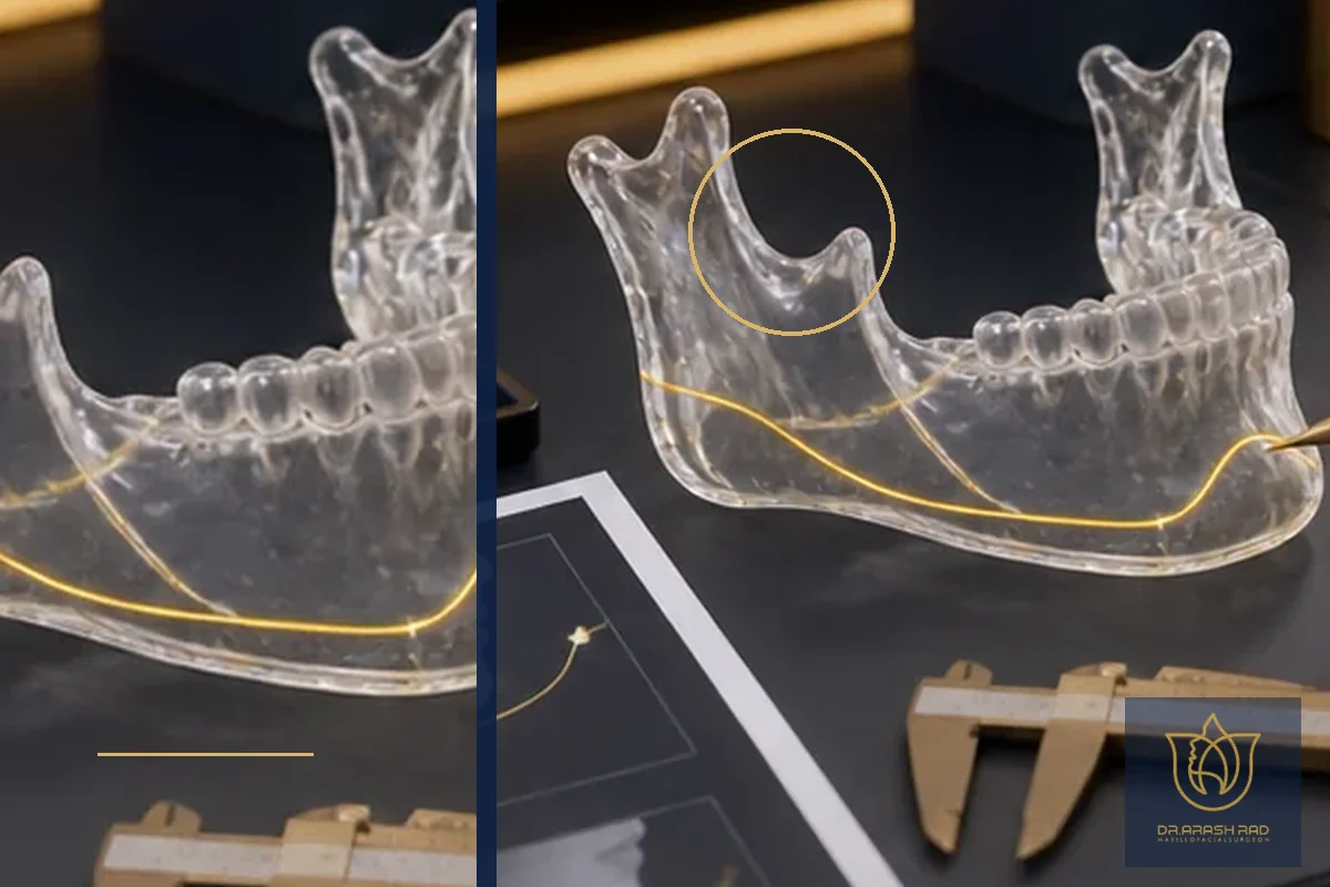 3D Planning and Imaging for Precise V-Line Results: An Advanced Digital Workflow