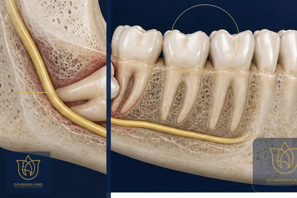 Wisdom Tooth Extraction with Laser: 7 Benefits of This Advanced Method