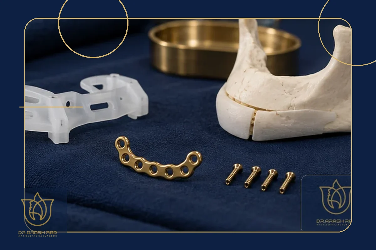 Chin Implant vs Genioplasty: A Scientific Framework for Determining the Ideal Structural Approach