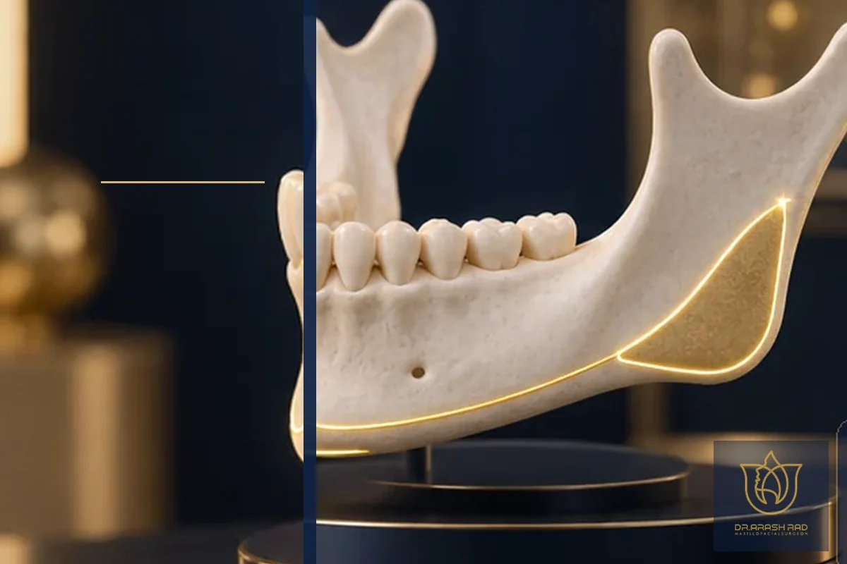 Choosing a Surgeon for V-line Surgery in Tehran: A Definitive Guide for International Patients