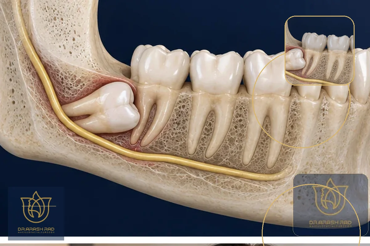 Dental Implants: Innovations in 3D Printing and Advanced Materials