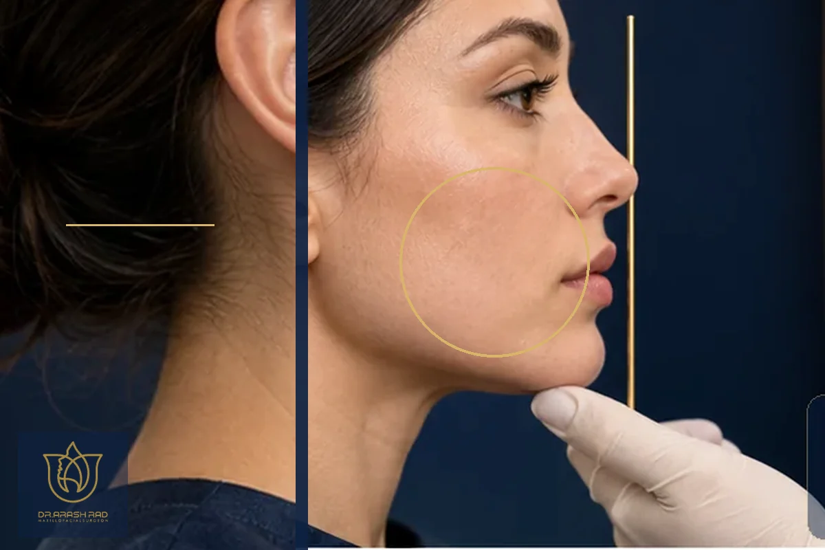 Double Chin Causes That May Surprise You (And What to Do About Them)