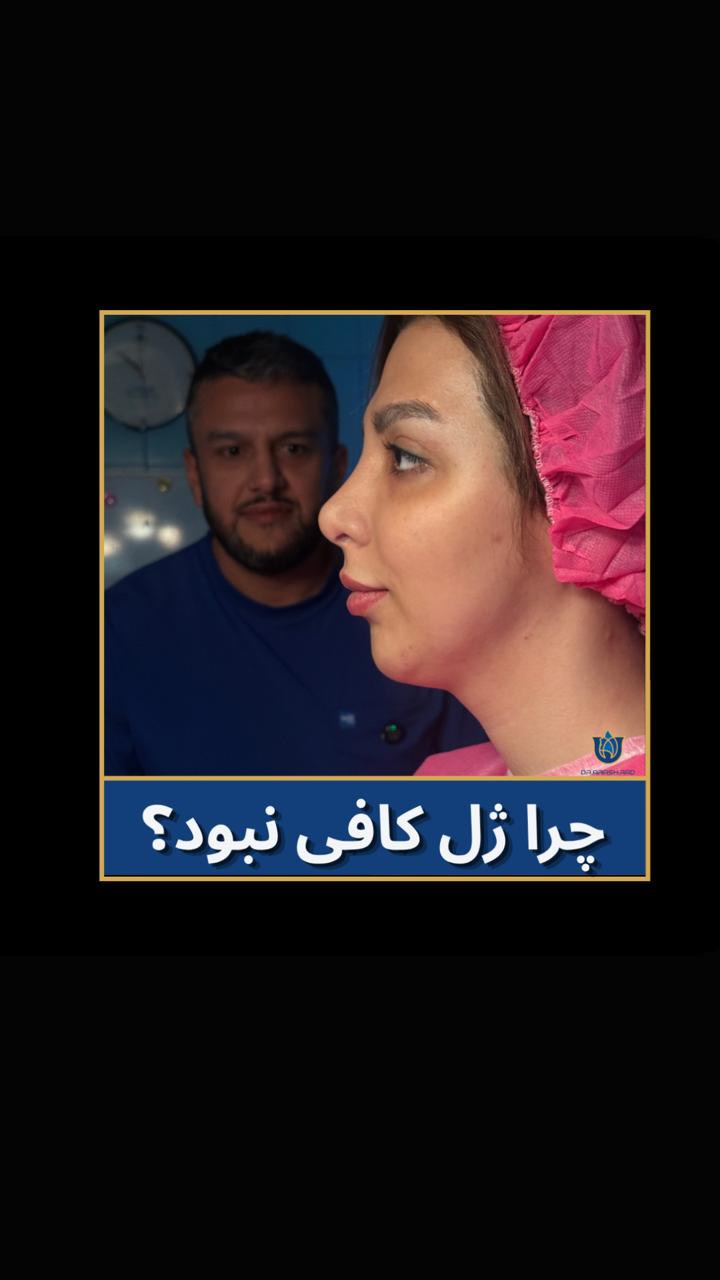 بررسی نیمرخ بیمار پیش از رینوپلاستی و ژنیوپلاستی همزمان