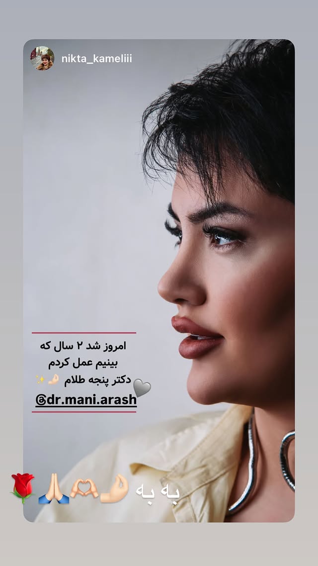 پیگیری نتیجه جراحی بینی پس از دو سال
