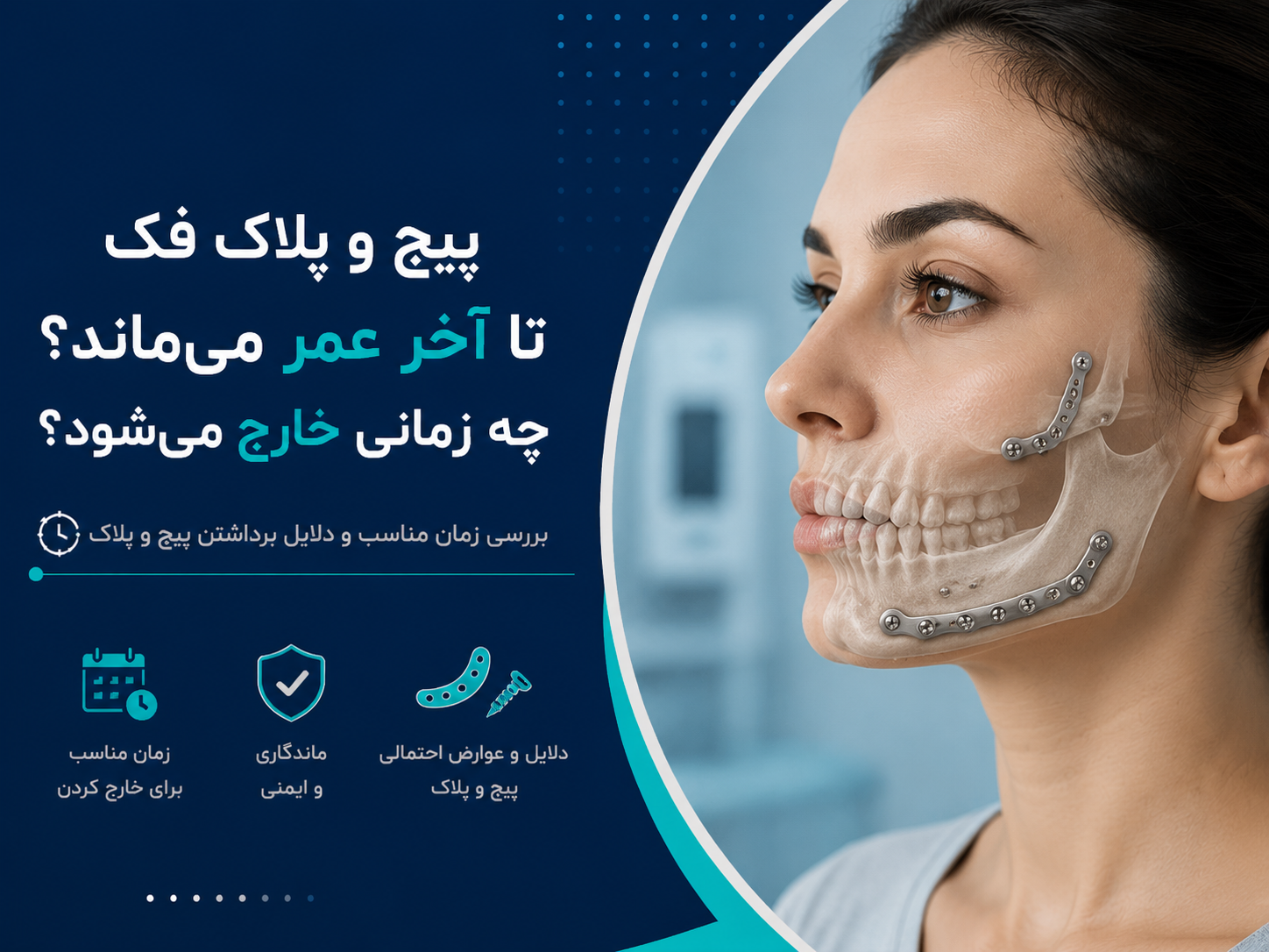 پیچ و پلاک فک تا آخر عمر می‌ماند؟ چه زمانی خارج می‌شود؟
