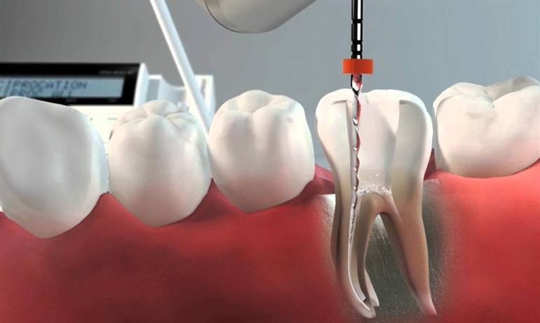 انواع جراحی دندان و دهان