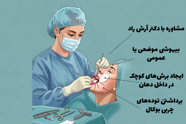 حذف چربی بوکال