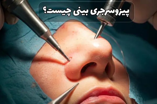 پیزوسرجری بینی