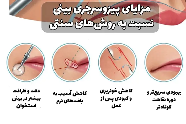 پیزوسرجری بینی