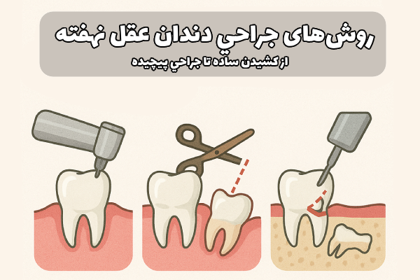 جراحي دندان عقل نهفته 