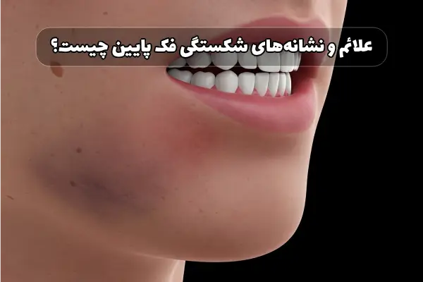 جراحی شکستگی فک پایین