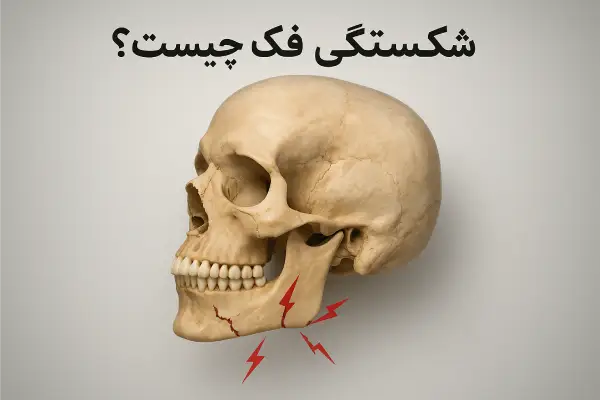 جراحی شکستگی فک