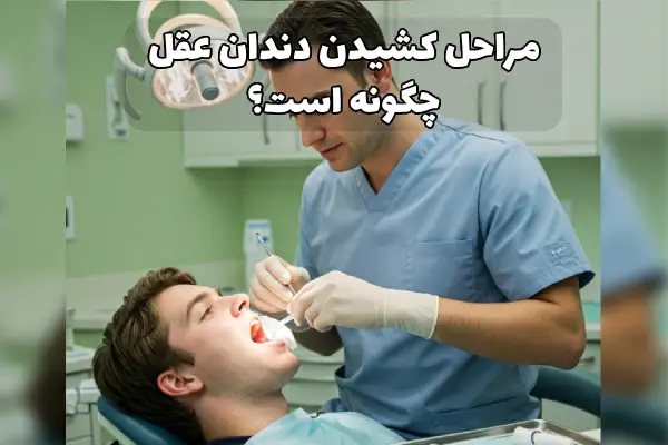 كشيدن دندان عقل
