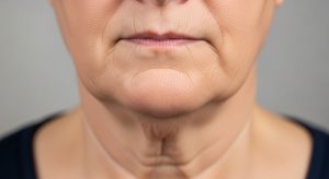 double chin fat vs sagging skin