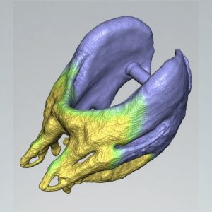 3D planning and imaging for precise V-line results
