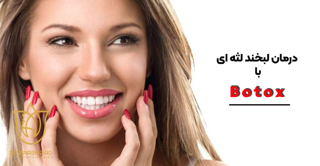 درمان لبخند لثه ‌ای با بوتاکس