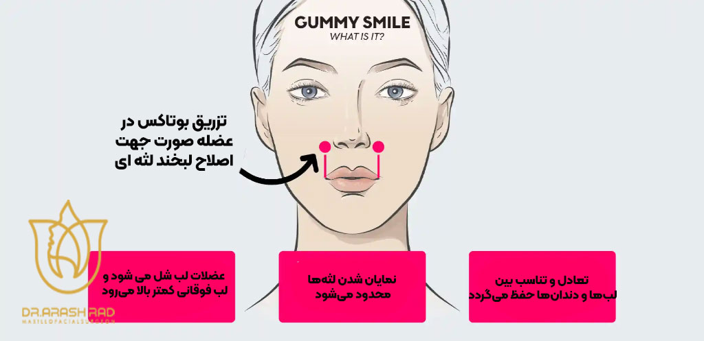 عملکرد بوتاکس 