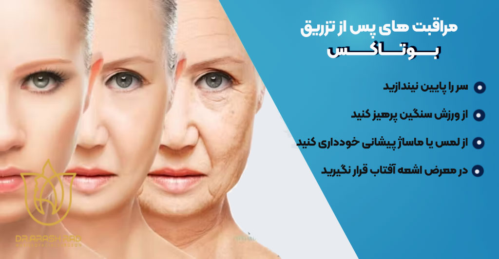 مراقبت‌های قبل و بعد از تزریق بوتاکس