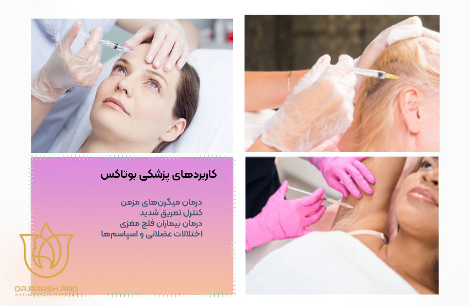 کاربردهای پزشکی بوتاکس