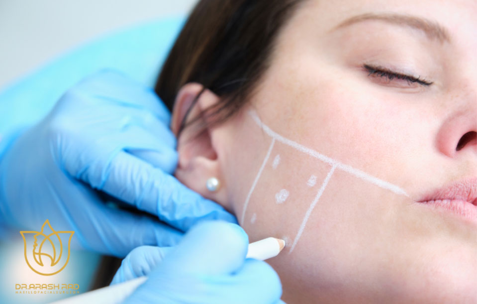 نقاط اصلی تزریق بوتاکس برای دندان قروچه