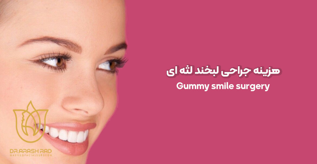 هزینه جراحی لبخند لثه ای