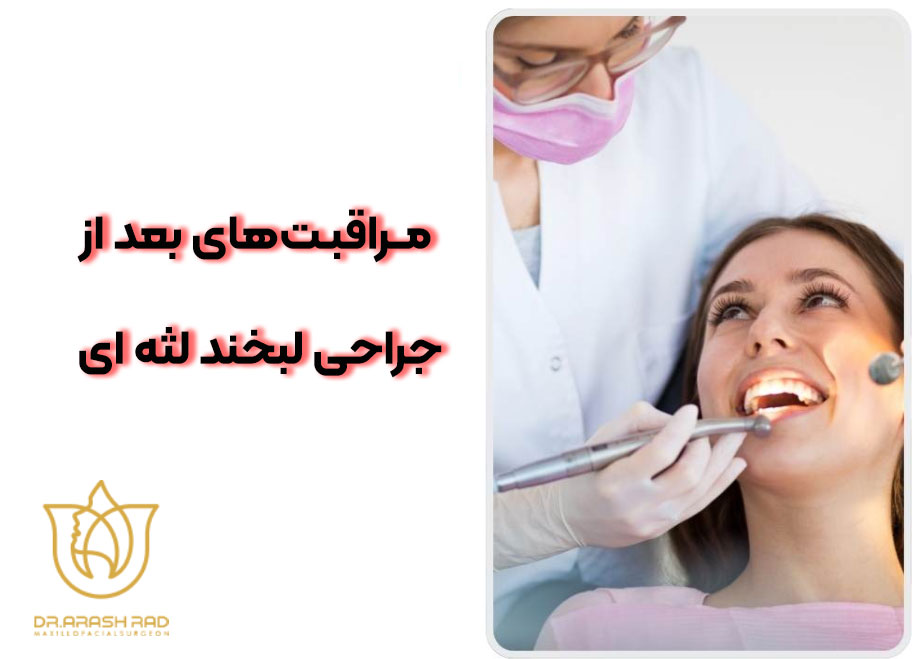 مراقبت‌های بعد از جراحی لبخند لثه ‌ای