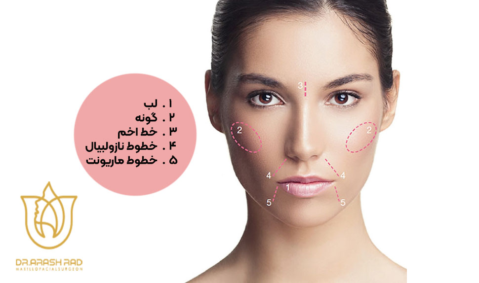 کاربردهای فیلر صورت
