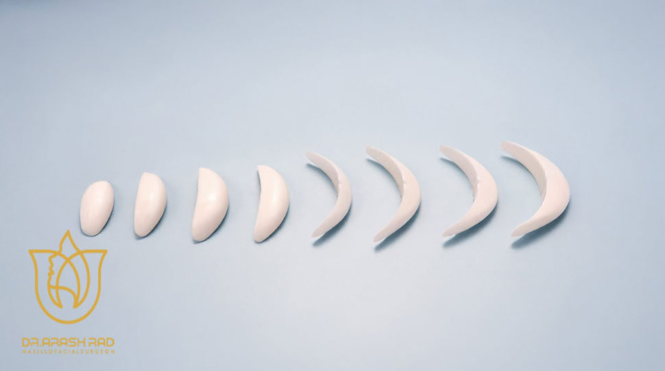 انواع پروتز چانه