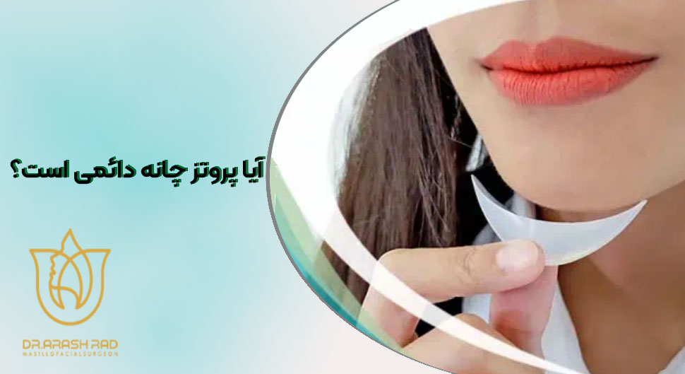 ماندگاری پروتز چانه