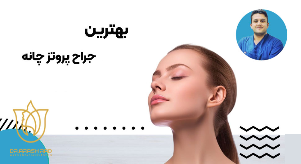 بهترین جراح پروتز چانه