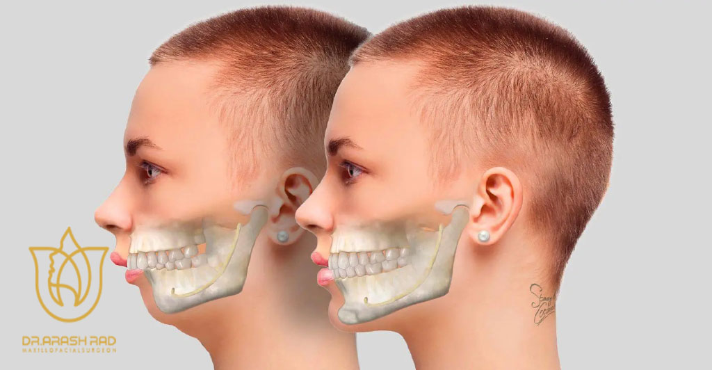 جراحی فک چیست