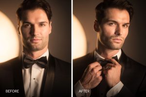 jaw contouring for men Dubai