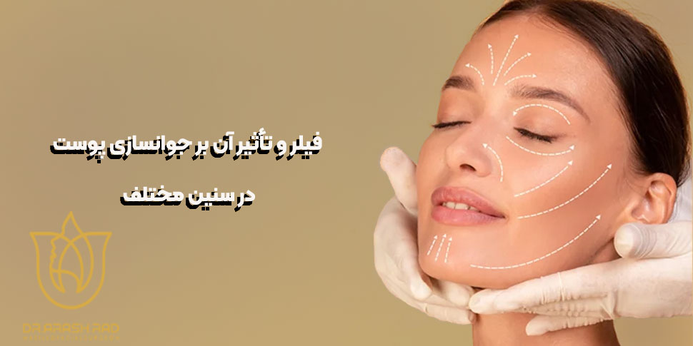 تأثیر فیلر بر جوانسازی پوست در سنین مختلف