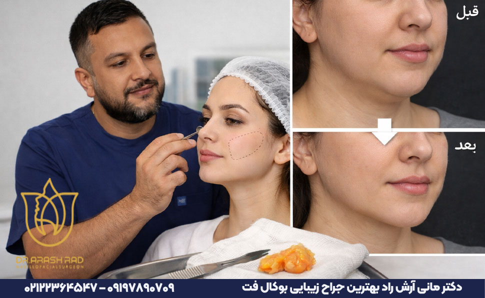 راز ماندگاری بوکال فت با دکتر مانی آرش راد