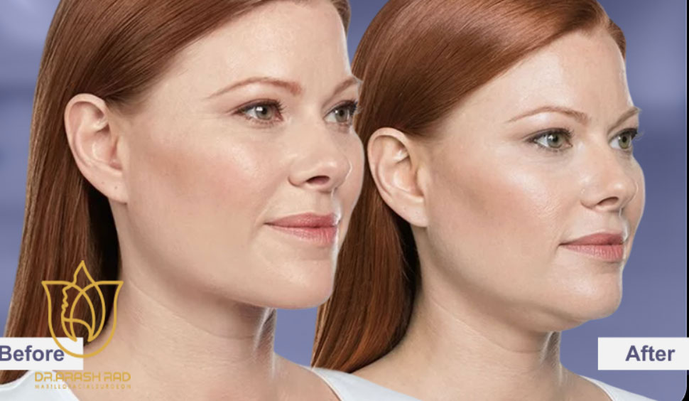 بهترین سن برای بوکال فت