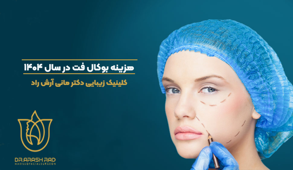 هزینه بوکال فت