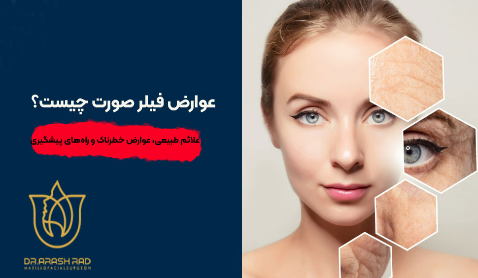 عوارض فیلر صورت چیست؟