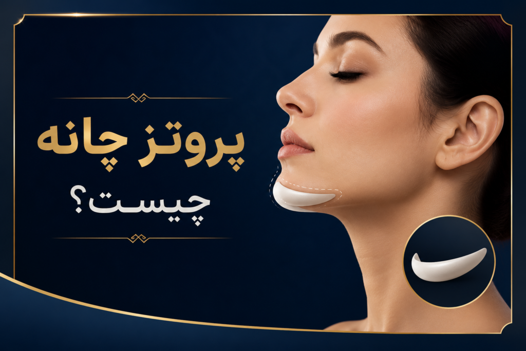پروتز چانه چیست؟