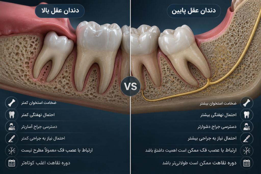 مقایسه کشیدن دندان عقل بالا و پایین