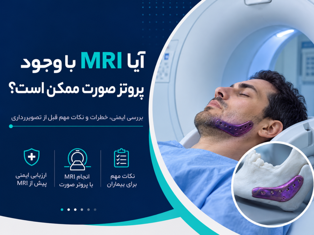آیا MRI با وجود پروتز صورت امکان‌پذیر است؟