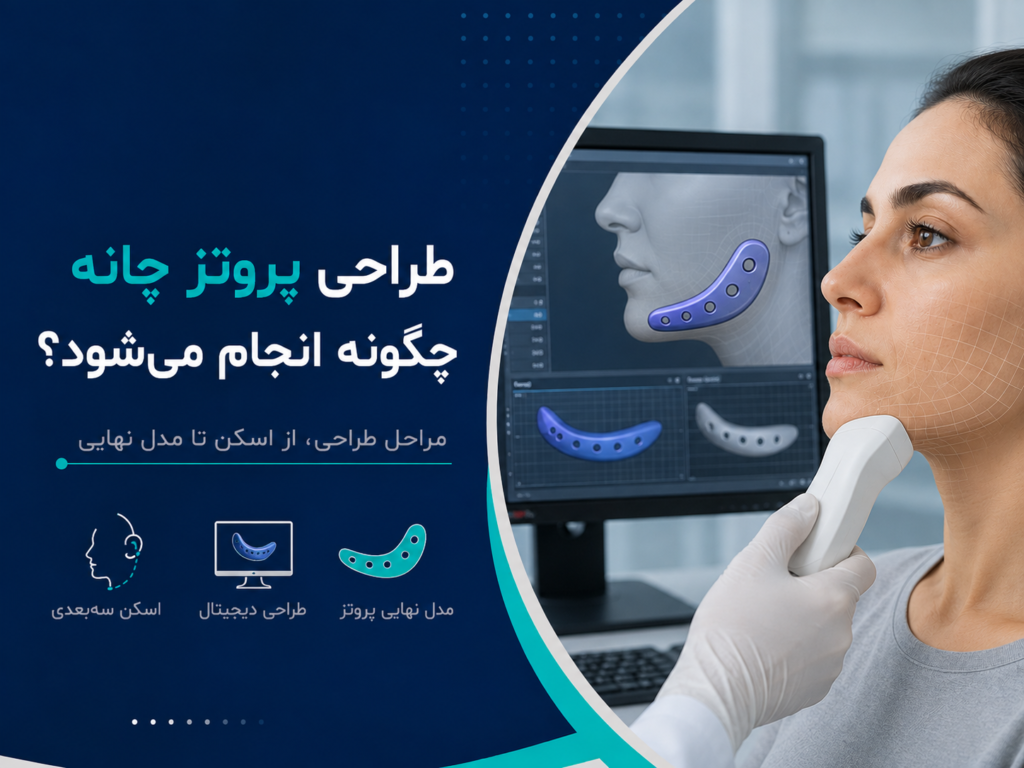 طراحی پروتز چانه چگونه انجام می‌شود؟