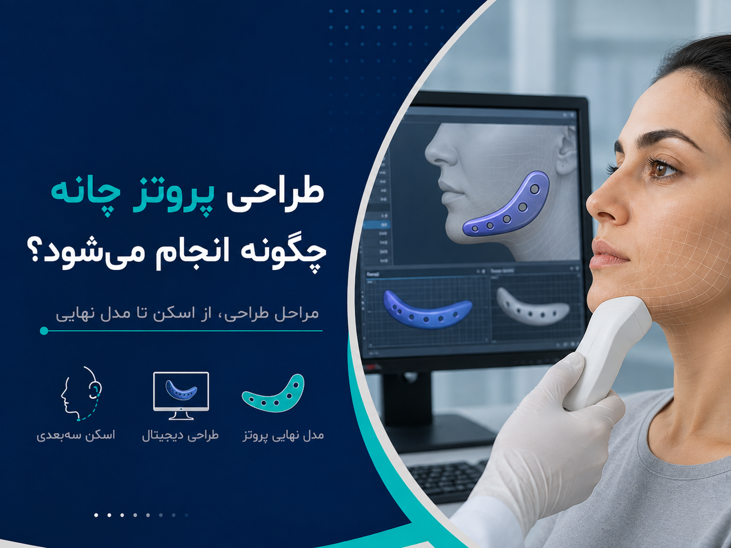 طراحی پروتز چانه چگونه انجام می‌شود؟