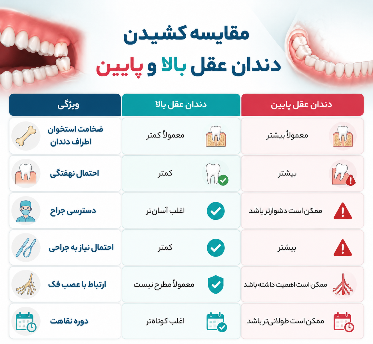 مقایسه کشیدن دندان عقل بالا و پایین