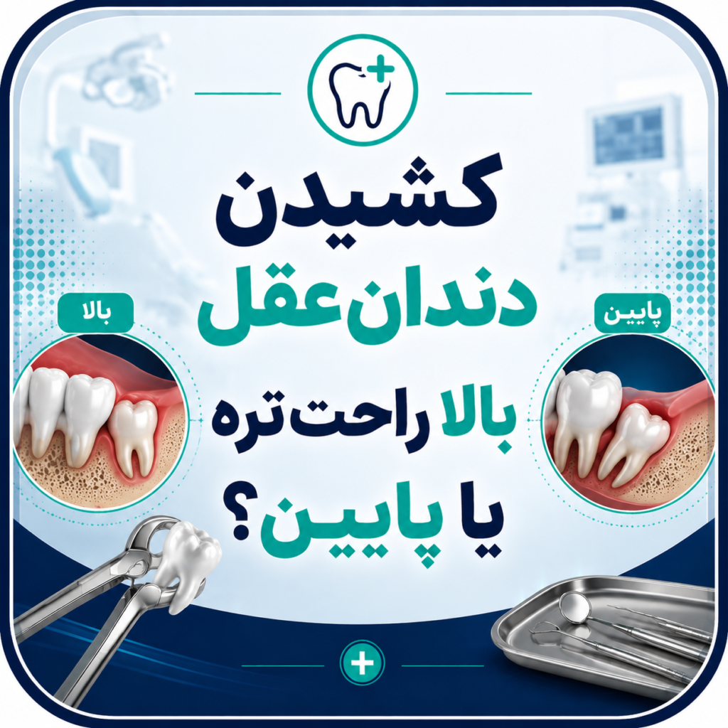 کشیدن دندان عقل بالا راحت‌تره یا پایین؟