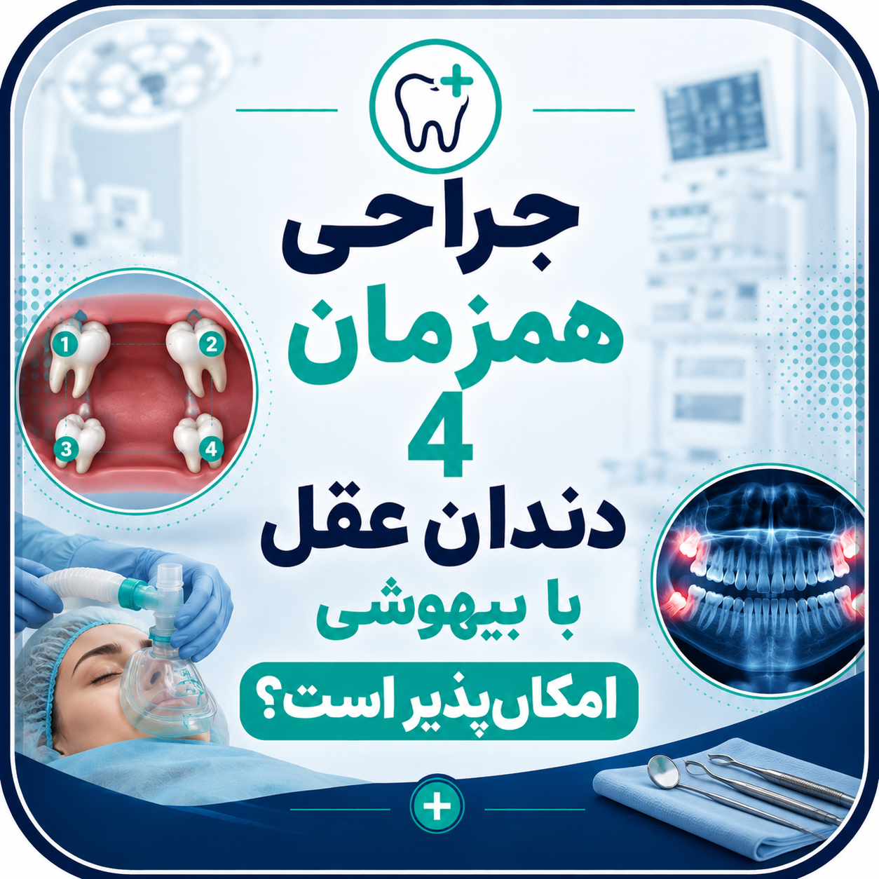 جراحی همزمان 4 دندان عقل با بیهوشی امکان‌پذیر است؟
