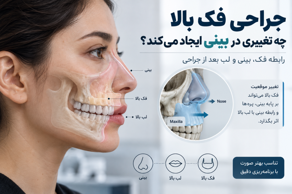 تأثیر جراحی فک بالا روی بینی؛ آیا فرم بینی تغییر میکند؟