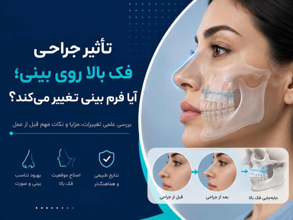 تأثیر جراحی فک بالا روی بینی؛ آیا فرم بینی تغییر می‌کند؟